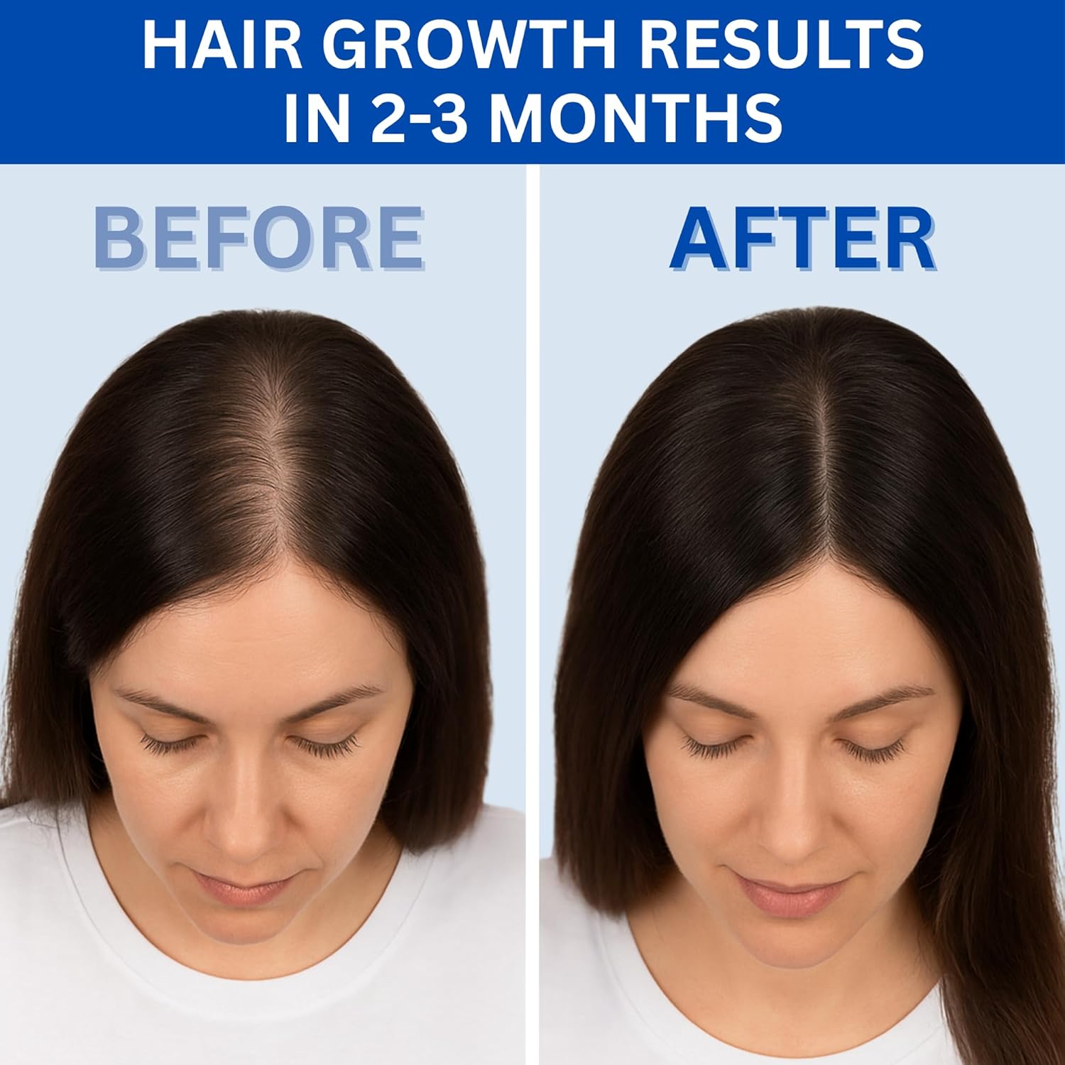 Before and after comparison of hair growth results with text indicating time frame.