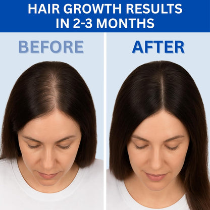 Before and after comparison of hair growth results with text indicating time frame.