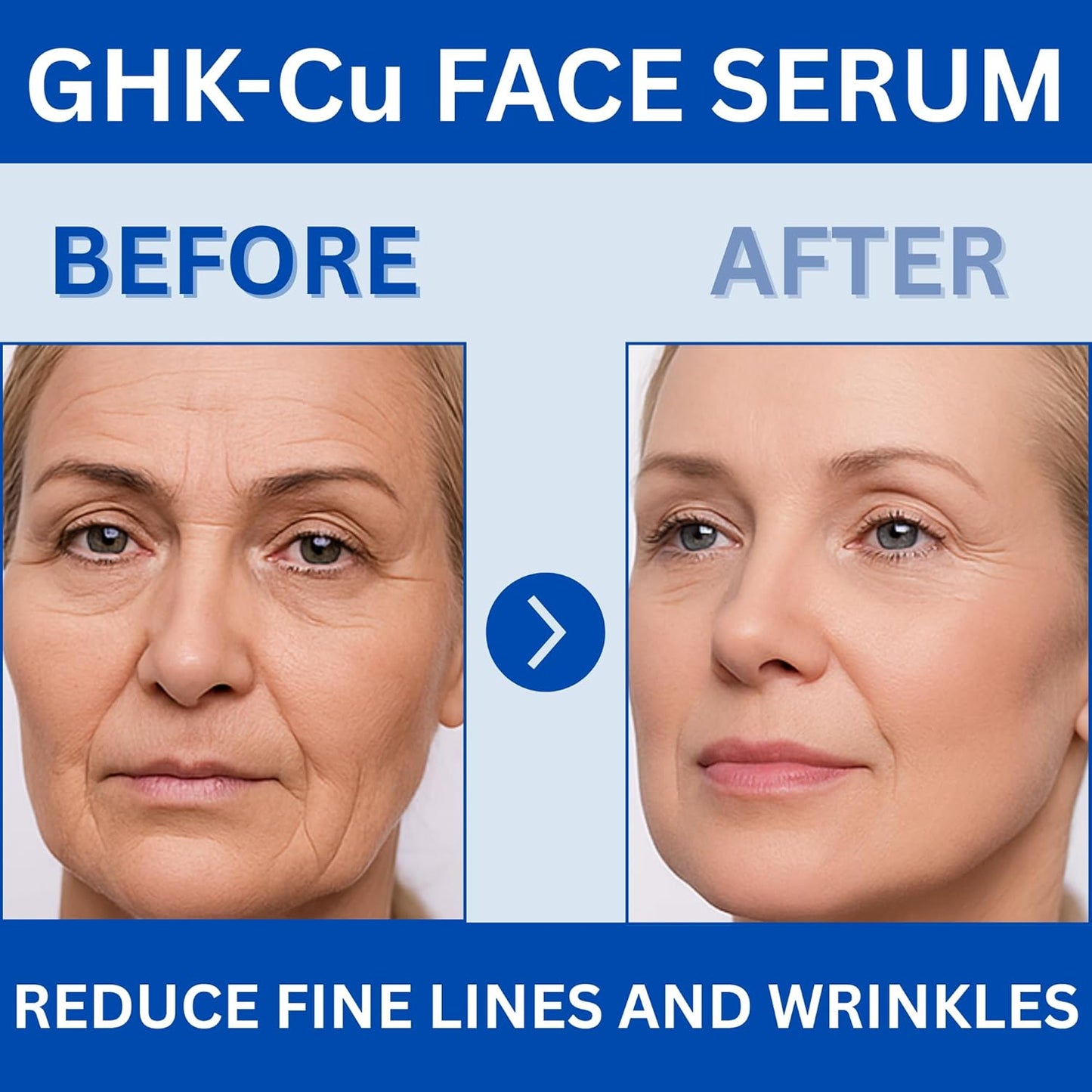 Before and after effect of GHK-Cu face serum on a woman's face.